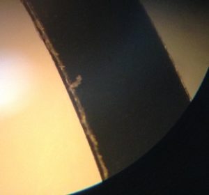 old vendor micrograph of fuzz